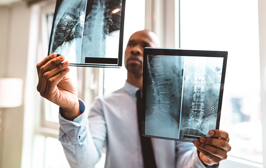 Doctor evaluating spine X-rays